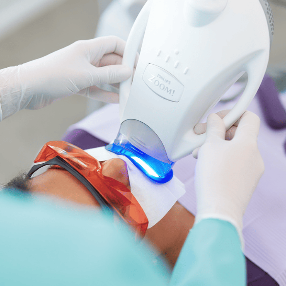 Профессинальное отбеливание зубов ZOOM-4