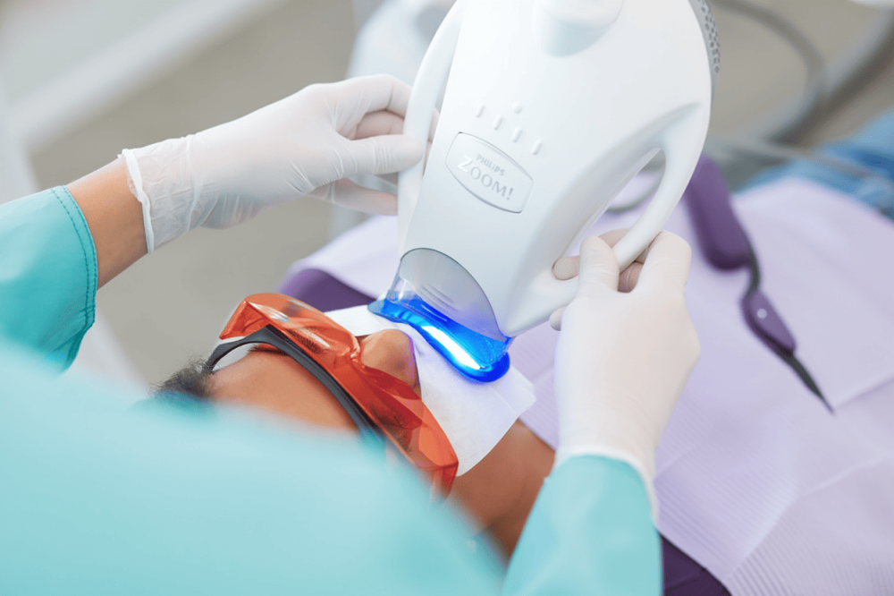 Профессинальное отбеливание зубов ZOOM-4